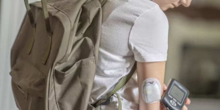 Discover how advanced technologies from Molex are revolutionizing wearable CGMs, creating ultra-compact devices for reliable and discreet glucose monitoring.