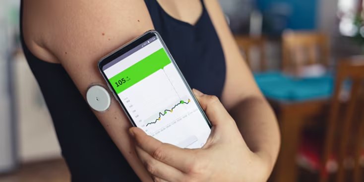 A person holds a smartphone displaying a glucose monitoring app, showing a reading of 105. The individual is wearing a continuous glucose monitor sensor on their upper arm.