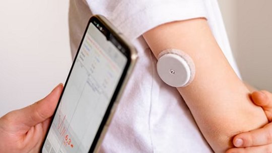 A child’s arm is fitted with a round glucose monitoring sensor while a smartphone displays related health data.