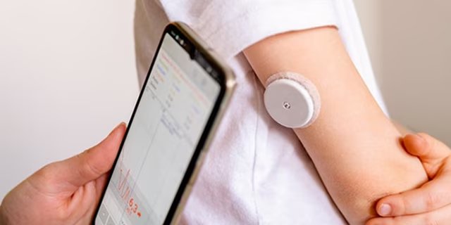 A child’s arm is fitted with a round glucose monitoring sensor while a smartphone displays related health data.