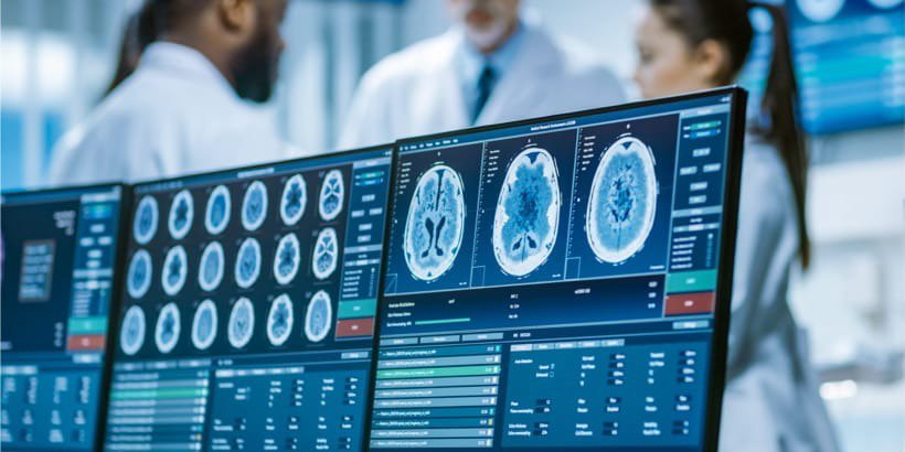 A group of medical professionals in a modern laboratory setting examines brain scan images displayed on multiple monitors.