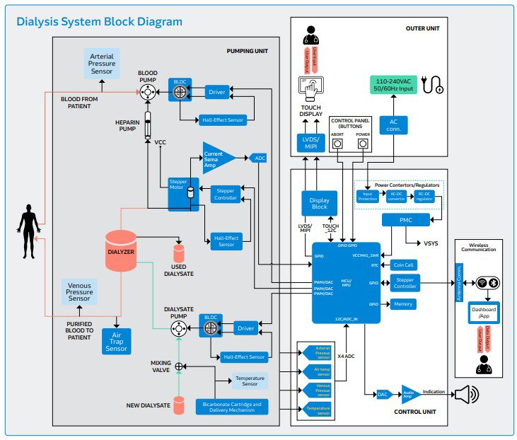 A detailed block diagram illustrating the components and workflow of a dialysis system