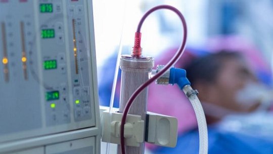 Primo piano di una macchina per dialisi medica con tubi e componenti di filtrazione visibili