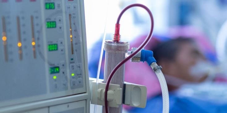 Gros plan d'une machine de dialyse médicale avec des tubes et des composants de filtration visibles