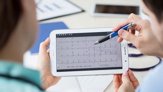 A healthcare worker holds a white tablet displaying an electrocardiogram (ECG) graph while another person points at the screen with a pen. 
