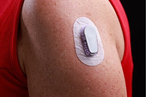 Close-up of a wearable medical device attached to the upper arm of an adult. The patch is secured with adhesive and features a compact, white sensor. The individual is wearing a red sleeveless shirt, emphasizing the arm and device placement.