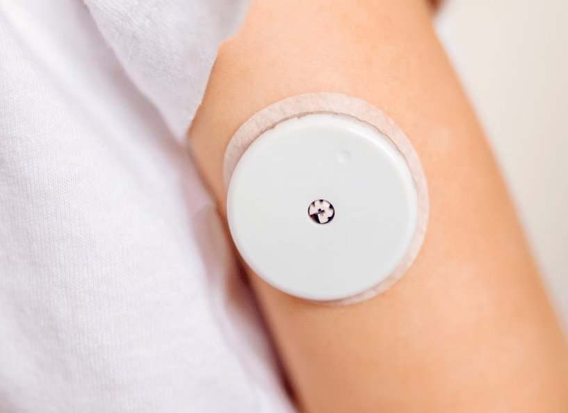 A close-up view of a circular wearable glucose monitoring device attached to the upper arm. 